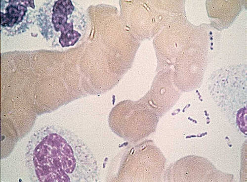Yersinia_pestis